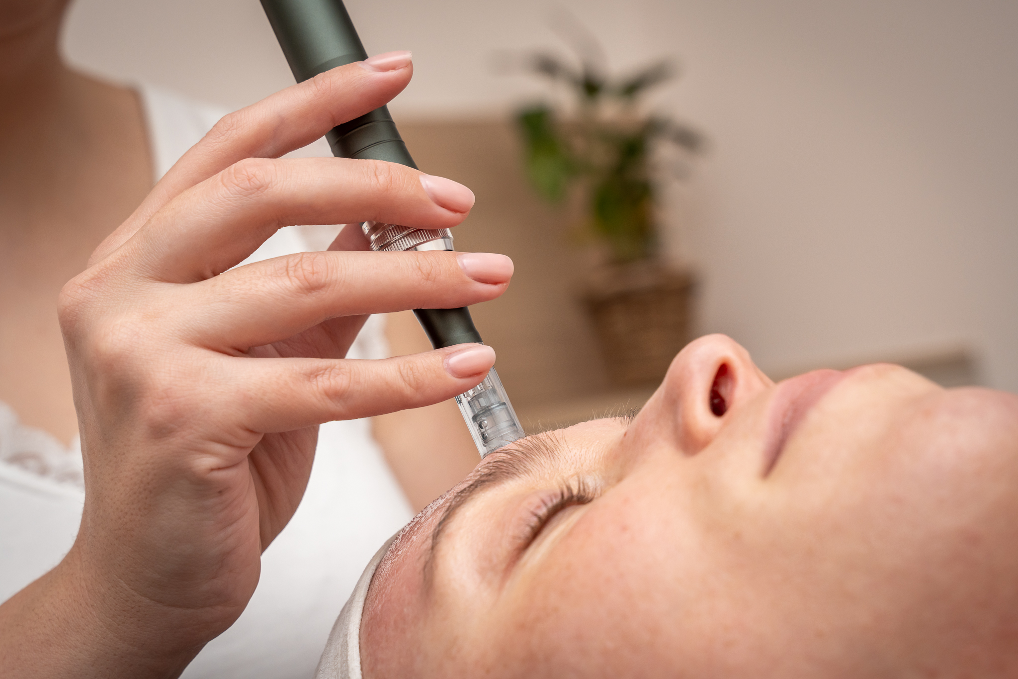 microneedling therapie